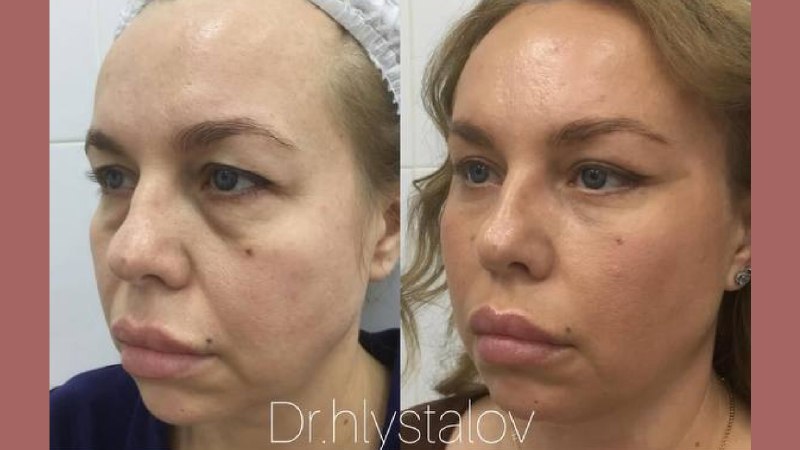 Пластический Хирург | Хлысталов Максим