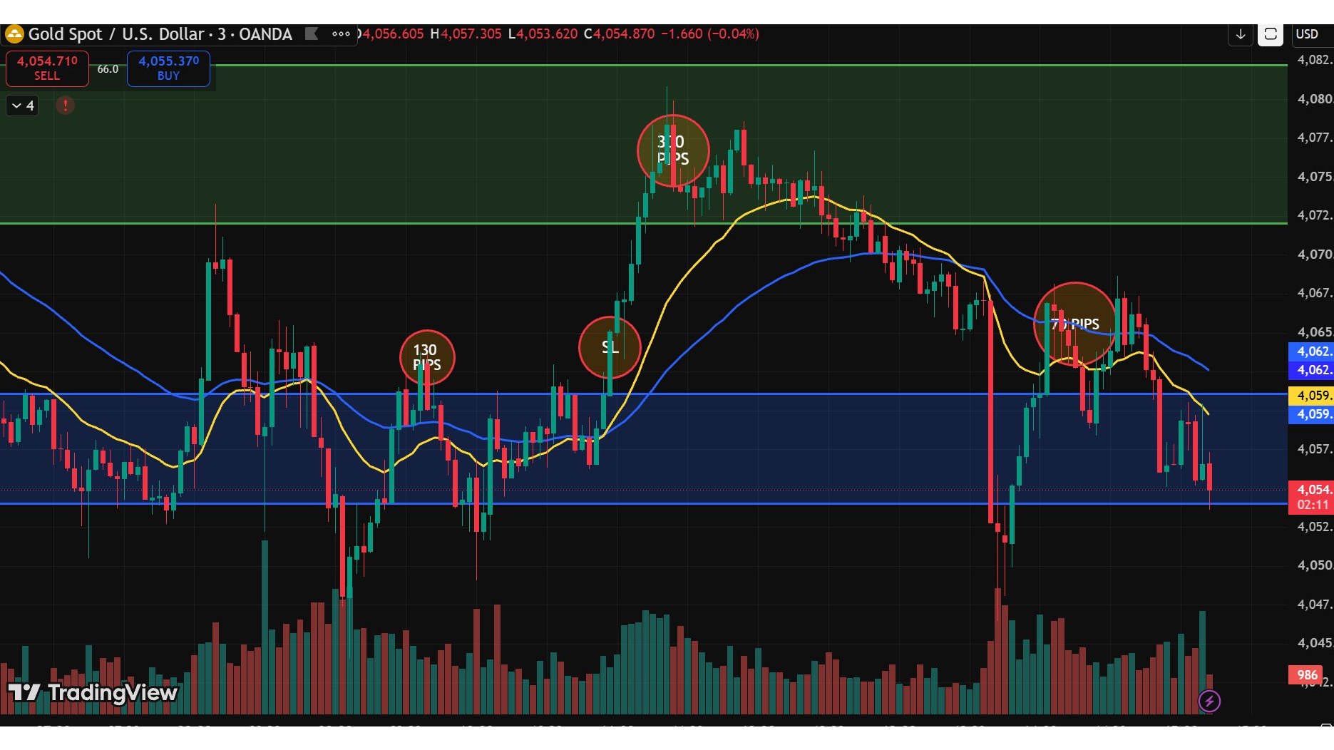 Sabin Gold Signals