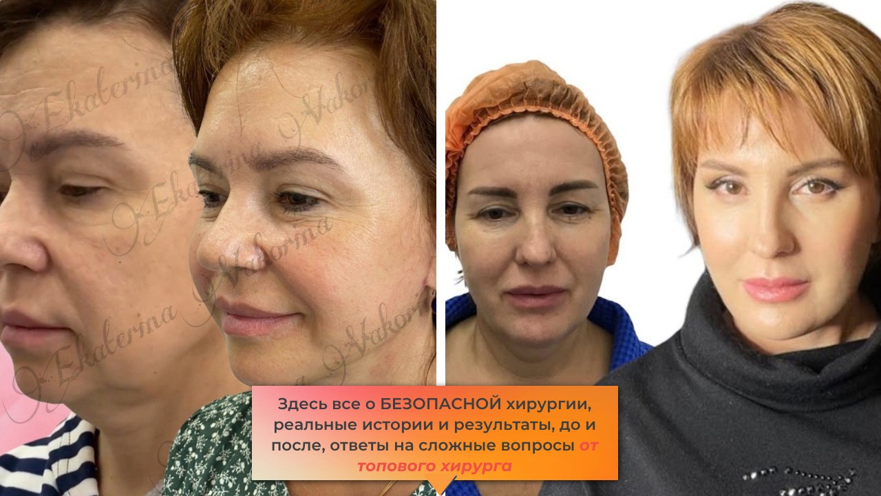 Екатерина Вакорина / Пластический хирург