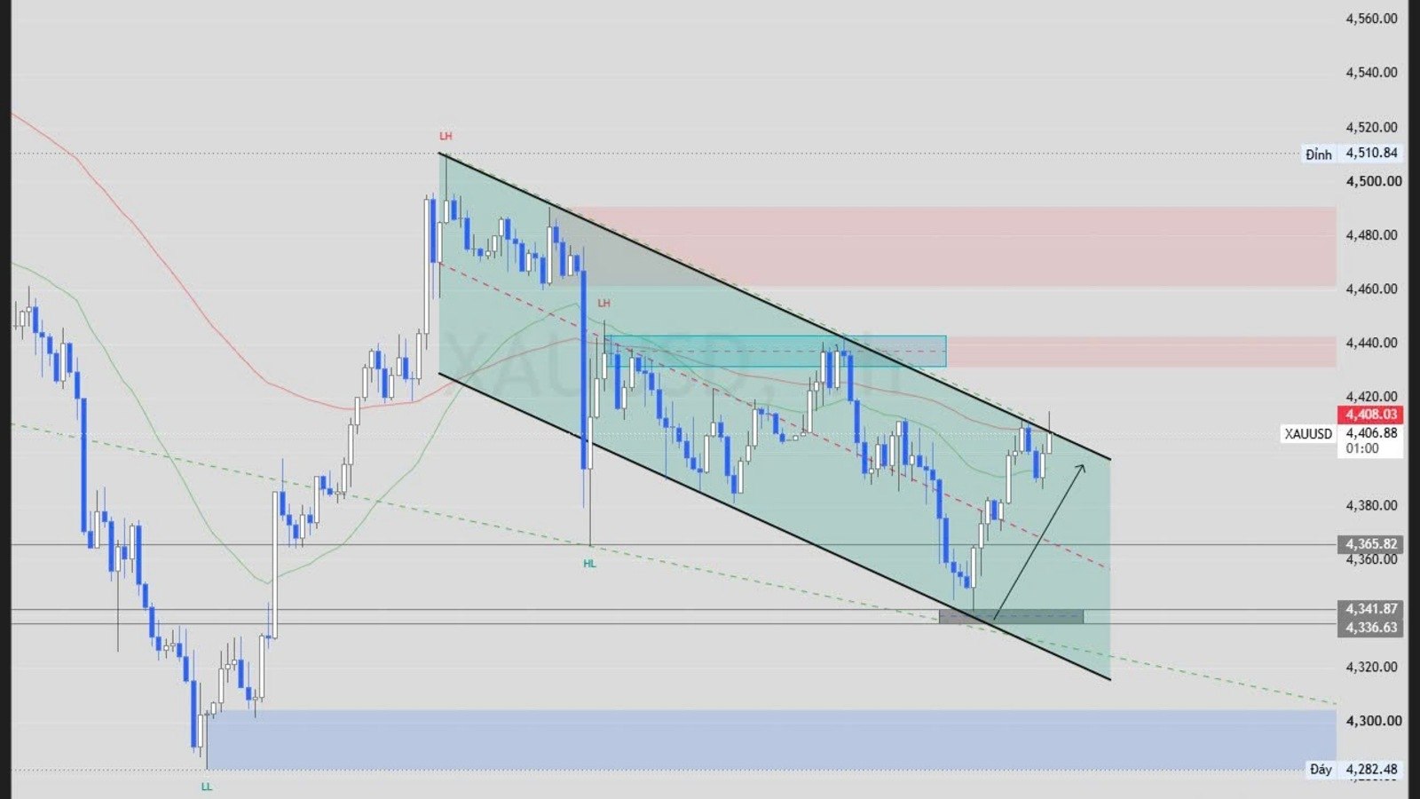 PARA FOREX CHANNEL 🇻🇳