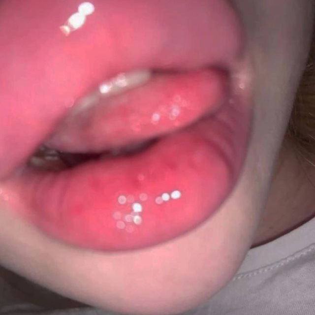 @miaen1